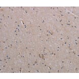 Immunohistochemistry - NAIP Antibody from Signalway Antibody (37749) - Antibodies.com