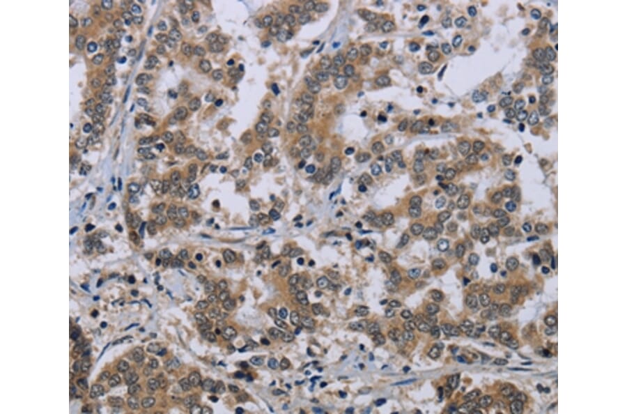 Immunohistochemistry - NEFH Antibody from Signalway Antibody (37759) - Antibodies.com
