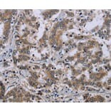 Immunohistochemistry - NEFH Antibody from Signalway Antibody (37759) - Antibodies.com