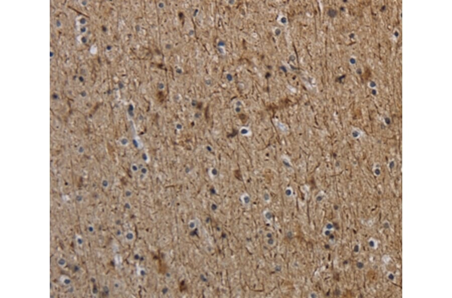 Immunohistochemistry - NEFH Antibody from Signalway Antibody (37759) - Antibodies.com