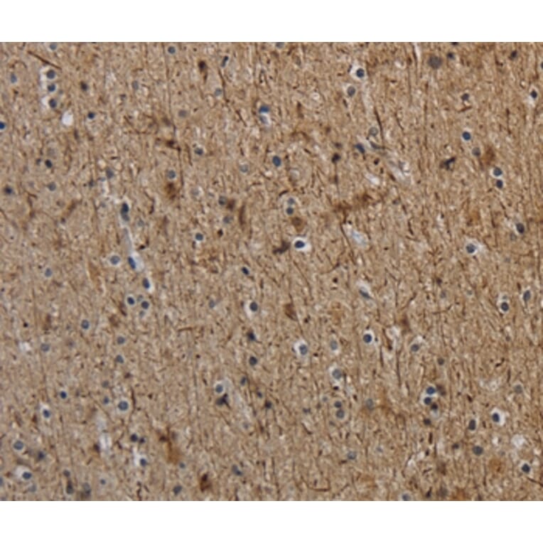 Immunohistochemistry - NEFH Antibody from Signalway Antibody (37759) - Antibodies.com