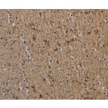 Immunohistochemistry - NEFH Antibody from Signalway Antibody (37759) - Antibodies.com