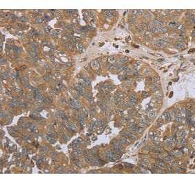 Immunohistochemistry - NPR2 Antibody from Signalway Antibody (37763) - Antibodies.com