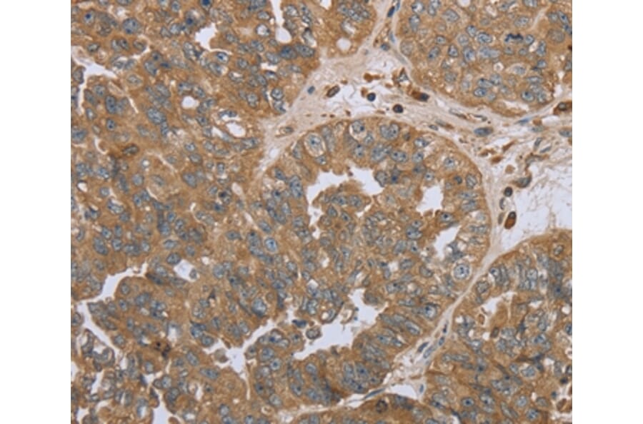 Immunohistochemistry - NPR2 Antibody from Signalway Antibody (37763) - Antibodies.com