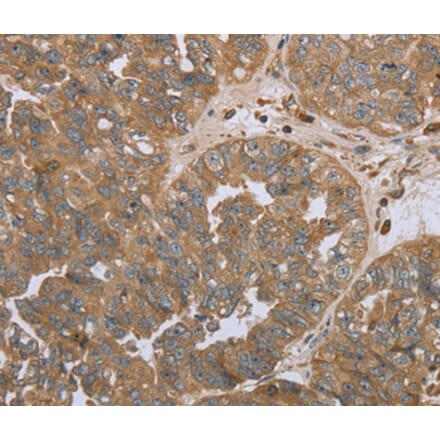 Immunohistochemistry - NPR2 Antibody from Signalway Antibody (37763) - Antibodies.com