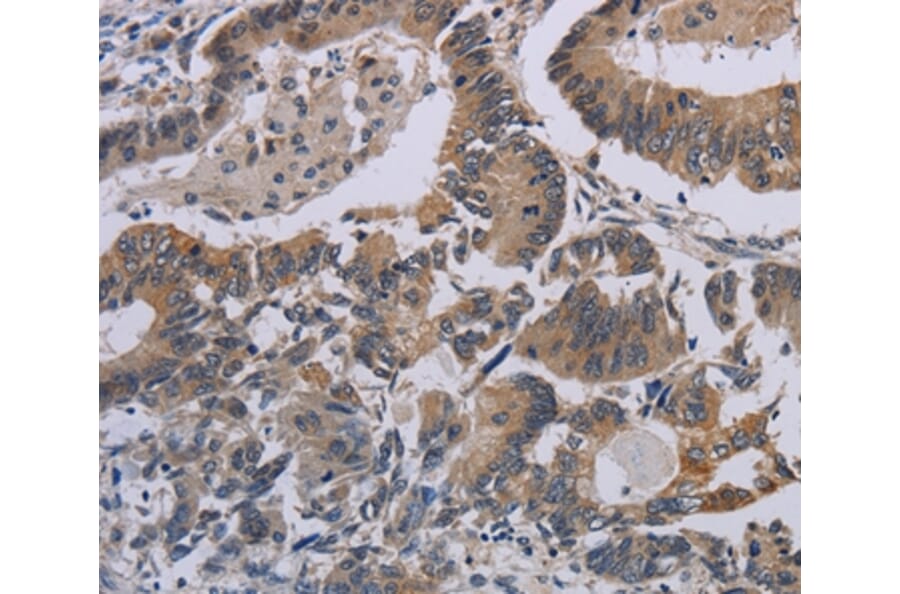 Immunohistochemistry - CCL1 Antibody from Signalway Antibody (37765) - Antibodies.com
