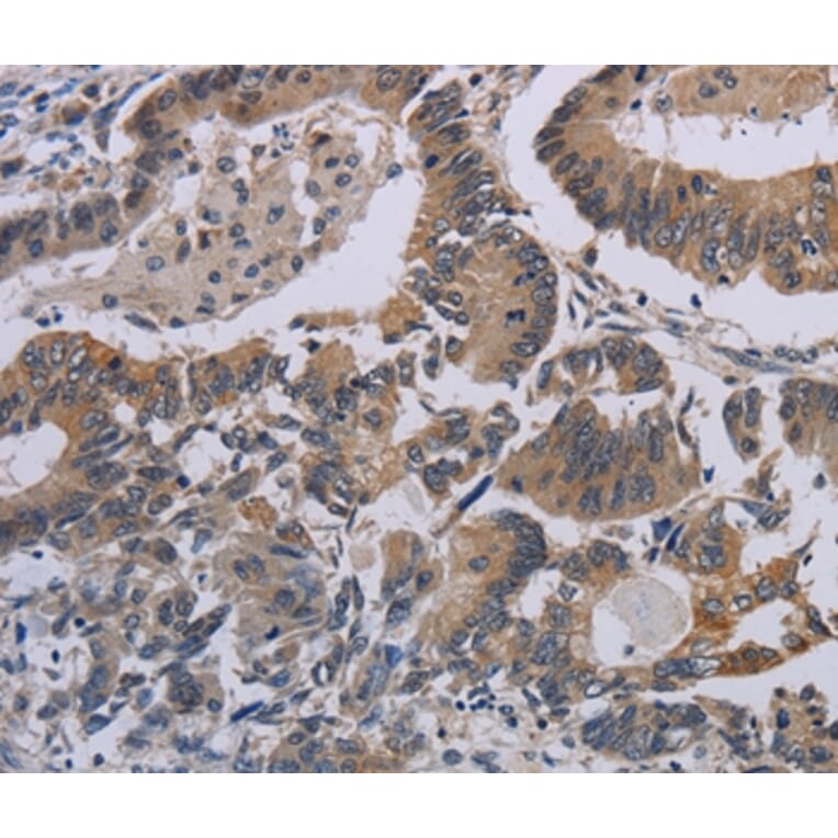 Immunohistochemistry - CCL1 Antibody from Signalway Antibody (37765) - Antibodies.com