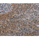 Immunohistochemistry - CCL1 Antibody from Signalway Antibody (37765) - Antibodies.com
