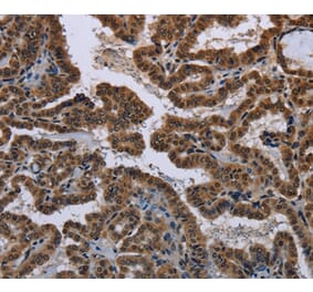 Immunohistochemistry - MYCN Antibody from Signalway Antibody (37770) - Antibodies.com
