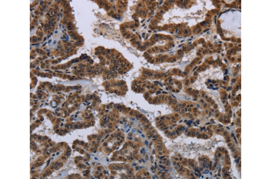 Immunohistochemistry - MYCN Antibody from Signalway Antibody (37770) - Antibodies.com