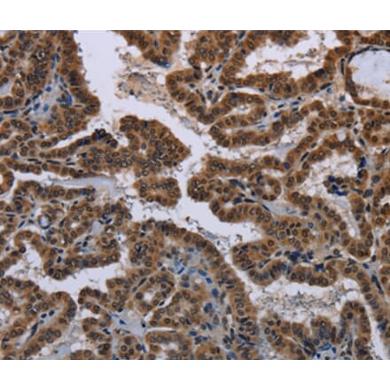 Immunohistochemistry - MYCN Antibody from Signalway Antibody (37770) - Antibodies.com