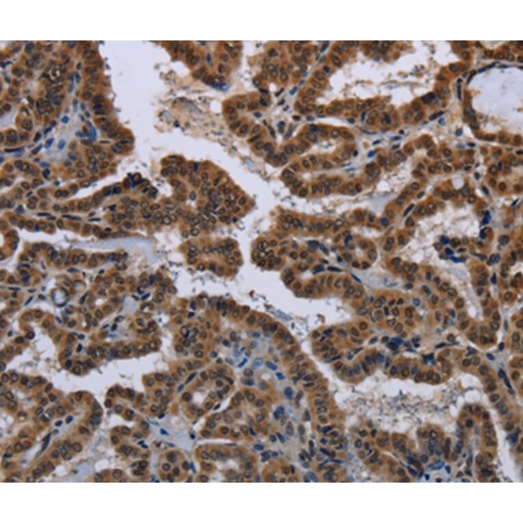 Immunohistochemistry - MYCN Antibody from Signalway Antibody (37770) - Antibodies.com