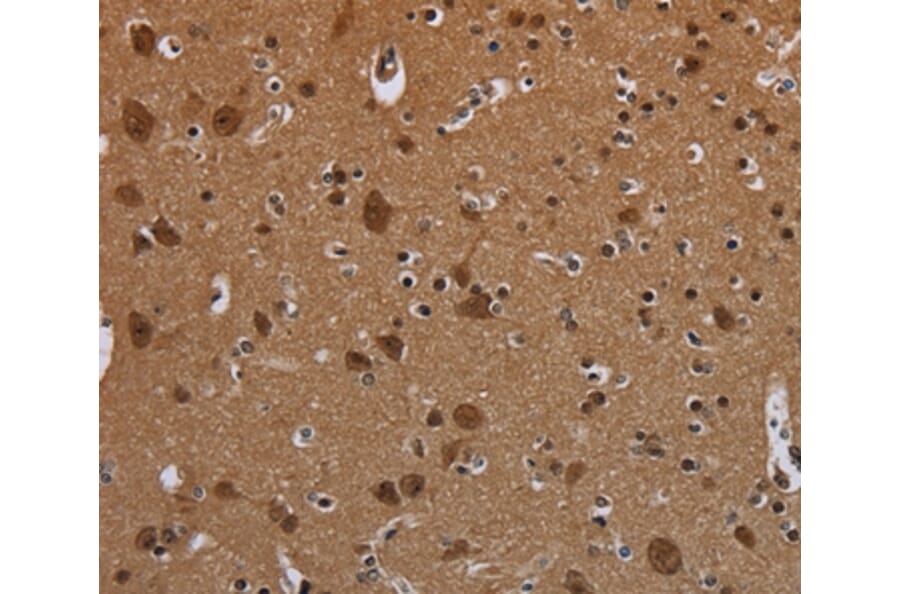 Immunohistochemistry - MYCN Antibody from Signalway Antibody (37770) - Antibodies.com