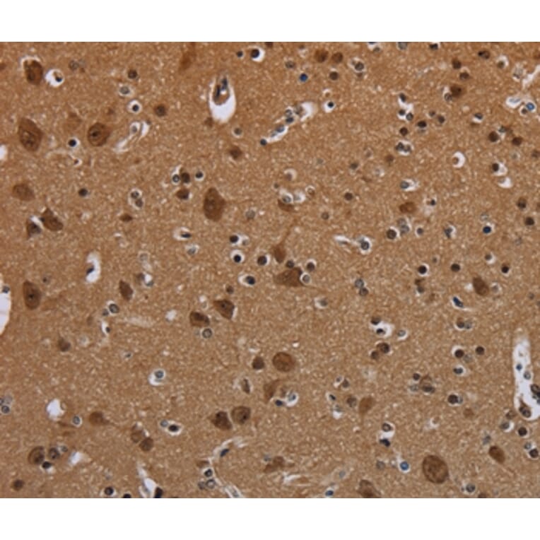 Immunohistochemistry - MYCN Antibody from Signalway Antibody (37770) - Antibodies.com