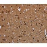 Immunohistochemistry - MYCN Antibody from Signalway Antibody (37770) - Antibodies.com