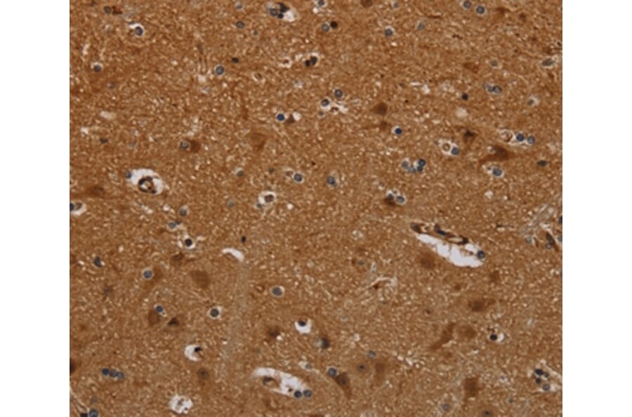 Immunohistochemistry - PNOC Antibody from Signalway Antibody (37771) - Antibodies.com