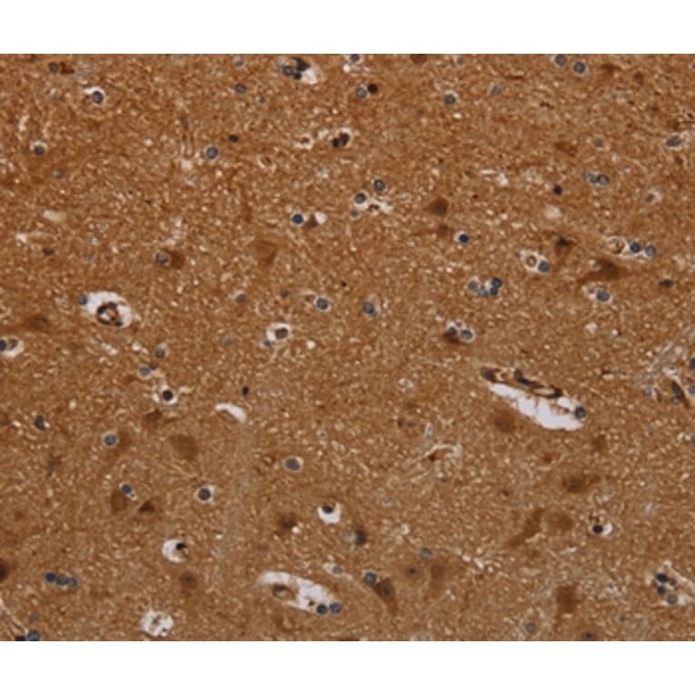 Immunohistochemistry - PNOC Antibody from Signalway Antibody (37771) - Antibodies.com