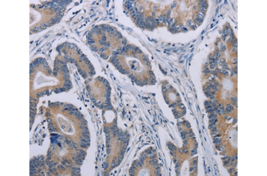 Immunohistochemistry - NOX1 Antibody from Signalway Antibody (37772) - Antibodies.com