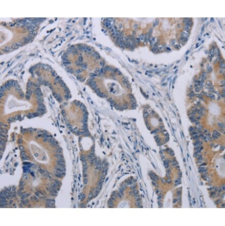 Immunohistochemistry - NOX1 Antibody from Signalway Antibody (37772) - Antibodies.com