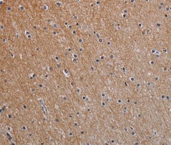 Immunohistochemical analysis of paraffin-embedded Human brain tissue using #37772 at dilution 1/40.