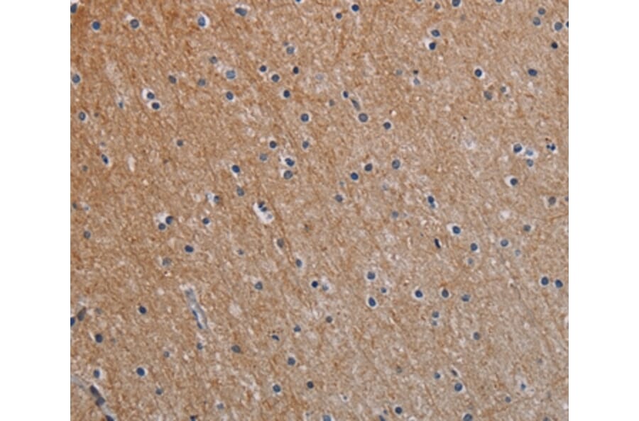 Immunohistochemistry - NOX1 Antibody from Signalway Antibody (37772) - Antibodies.com