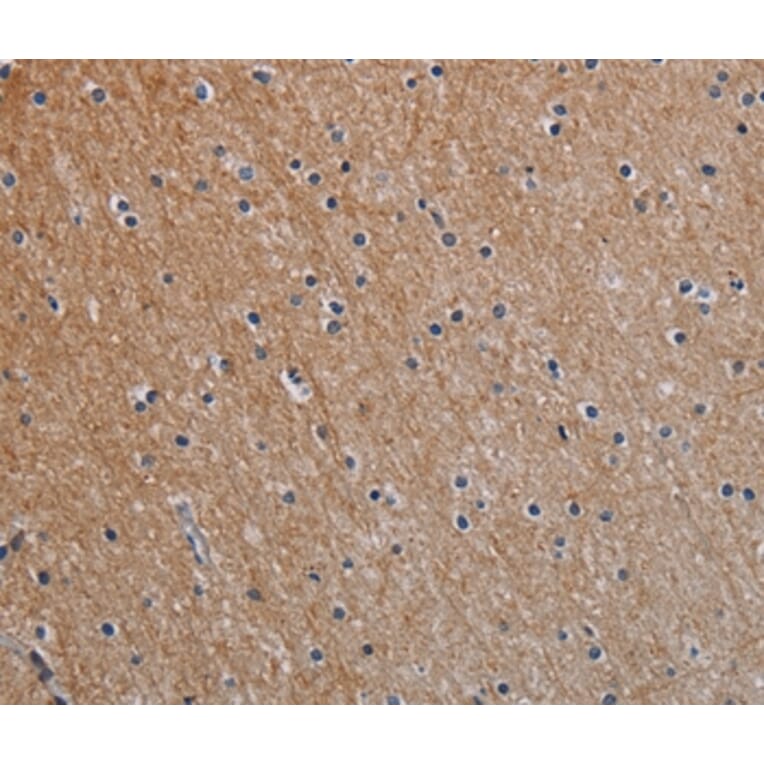 Immunohistochemistry - NOX1 Antibody from Signalway Antibody (37772) - Antibodies.com