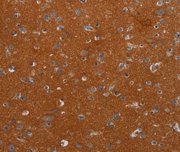 Immunohistochemical analysis of paraffin-embedded Human brain tissue using #37773 at dilution 1/40.