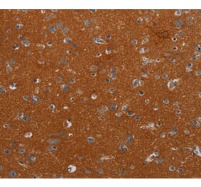 Immunohistochemistry - NOX3 Antibody from Signalway Antibody (37773) - Antibodies.com