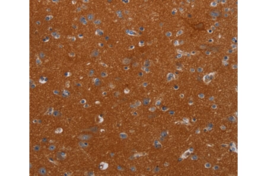 Immunohistochemistry - NOX3 Antibody from Signalway Antibody (37773) - Antibodies.com