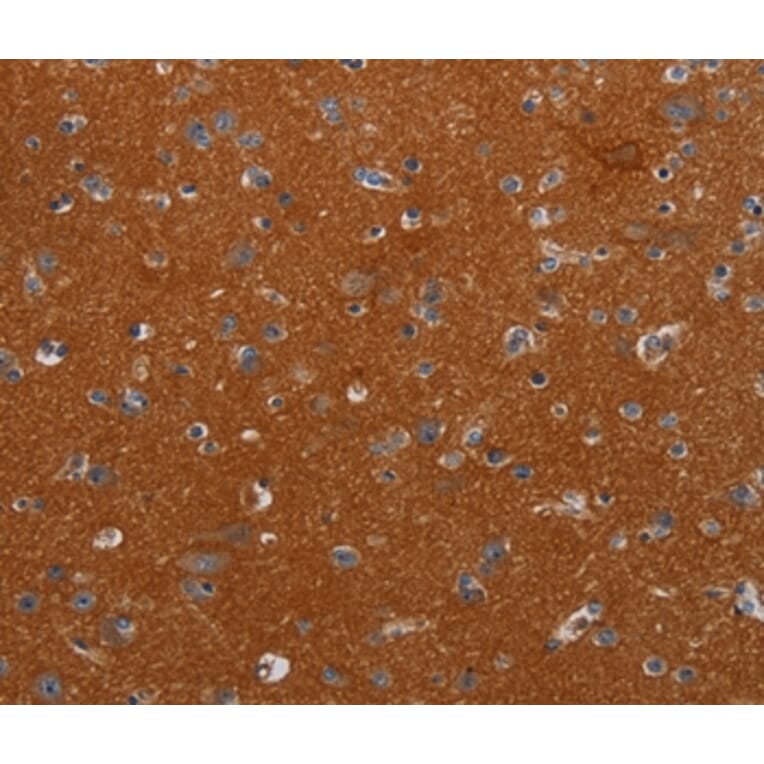 Immunohistochemistry - NOX3 Antibody from Signalway Antibody (37773) - Antibodies.com