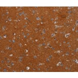 Immunohistochemistry - NOX3 Antibody from Signalway Antibody (37773) - Antibodies.com