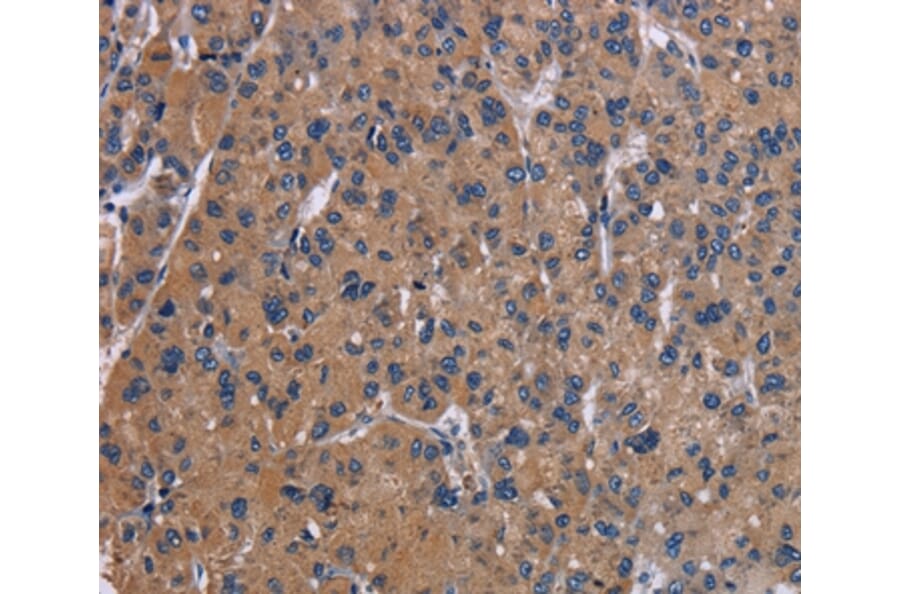 Immunohistochemistry - NPC1 Antibody from Signalway Antibody (37774) - Antibodies.com