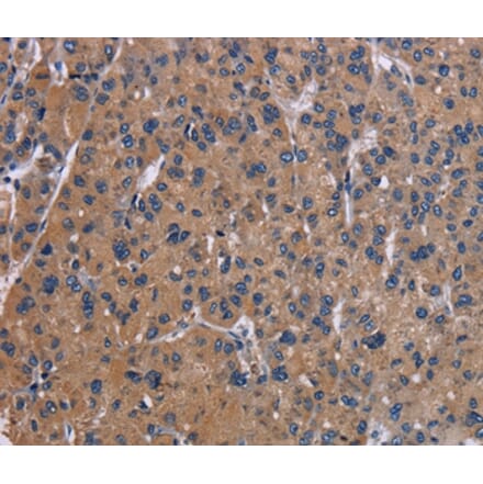 Immunohistochemistry - NPC1 Antibody from Signalway Antibody (37774) - Antibodies.com