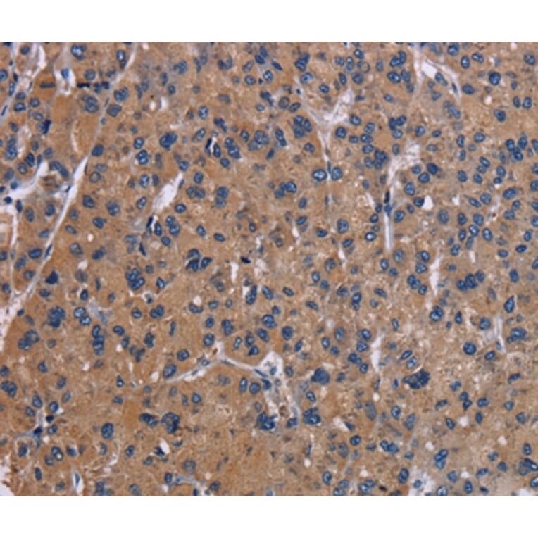 Immunohistochemistry - NPC1 Antibody from Signalway Antibody (37774) - Antibodies.com