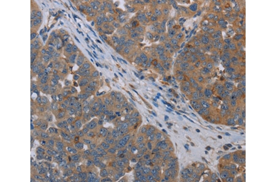 Immunohistochemistry - OTOR Antibody from Signalway Antibody (37784) - Antibodies.com