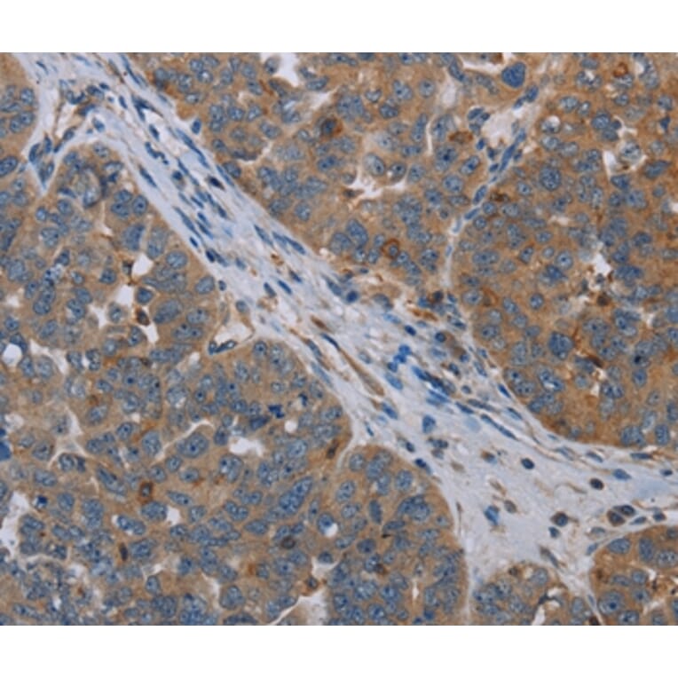 Immunohistochemistry - OTOR Antibody from Signalway Antibody (37784) - Antibodies.com