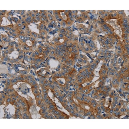 Immunohistochemistry - PER2 Antibody from Signalway Antibody (37814) - Antibodies.com