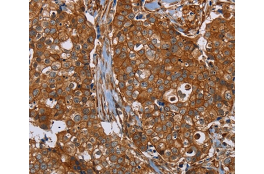 Immunohistochemistry - PLEC Antibody from Signalway Antibody (37832) - Antibodies.com