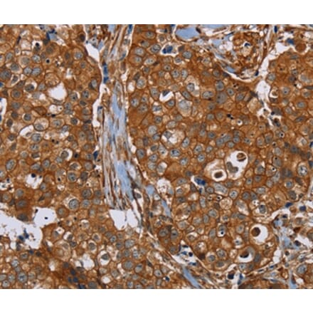 Immunohistochemistry - PLEC Antibody from Signalway Antibody (37832) - Antibodies.com