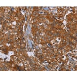 Immunohistochemistry - PLEC Antibody from Signalway Antibody (37832) - Antibodies.com