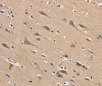 Immunohistochemical analysis of paraffin-embedded Human brain tissue using #37848 at dilution 1/40.