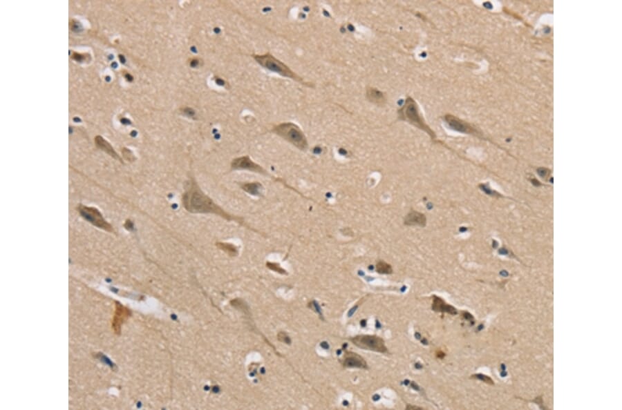 Immunohistochemistry - DLG2 Antibody from Signalway Antibody (37848) - Antibodies.com