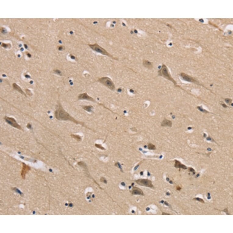Immunohistochemistry - DLG2 Antibody from Signalway Antibody (37848) - Antibodies.com