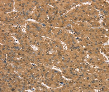 Anti-CD97 Antibody (A46962) | Antibodies.com