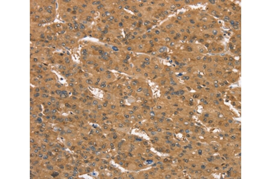 Immunohistochemistry - CD97 Antibody from Signalway Antibody (37886) - Antibodies.com