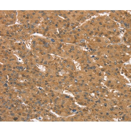 Immunohistochemistry - CD97 Antibody from Signalway Antibody (37886) - Antibodies.com