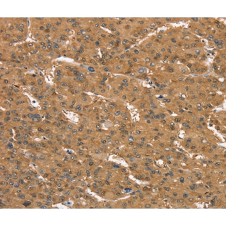 Immunohistochemistry - CD97 Antibody from Signalway Antibody (37886) - Antibodies.com