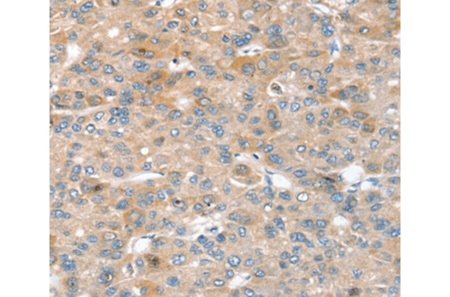 Immunohistochemistry - SIK1 Antibody from Signalway Antibody (37961) - Antibodies.com
