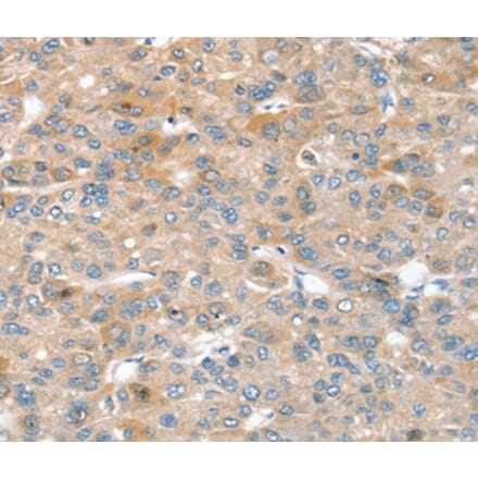 Immunohistochemistry - SIK1 Antibody from Signalway Antibody (37961) - Antibodies.com