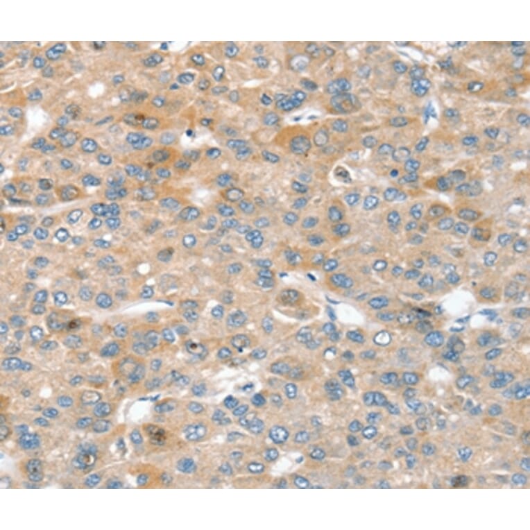 Immunohistochemistry - SIK1 Antibody from Signalway Antibody (37961) - Antibodies.com